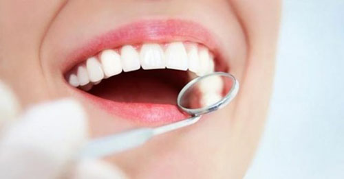 Tái khám răng sứ khi răng có vấn đề