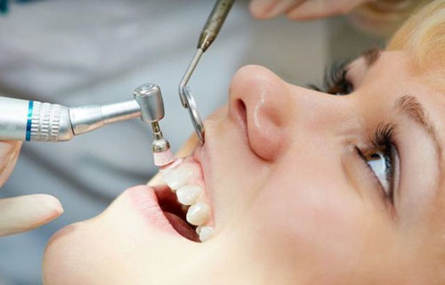 Tay nghề điều trị của bác sĩ bọc răng sứ