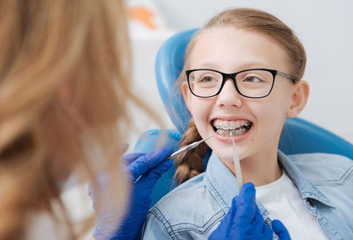 Thời điểm vàng để niềng răng cho trẻ là từ 12 – 16 tuổi