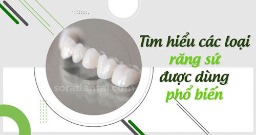 Tìm hiểu các loại răng sứ được dùng phổ biến