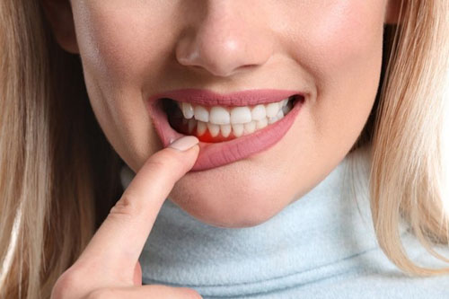 Tìm hiểu rủi ro sau khi bọc răng sứ