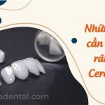 Điều cần biết về răng sứ Cercon HT với ưu điểm nổi bật