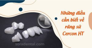 Read more about the article Điều cần biết về răng sứ Cercon HT với ưu điểm nổi bật