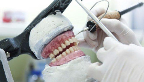 Quy trình chế tác răng sứ Emax