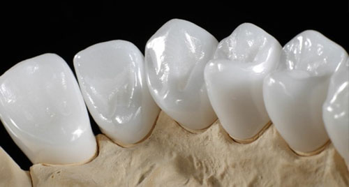 Răng sứ Hi – Zirconia sở hữu nhiều ưu điểm nổi bật