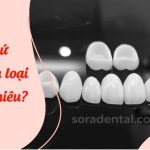 Răng sứ không kim loại giá bao nhiêu?