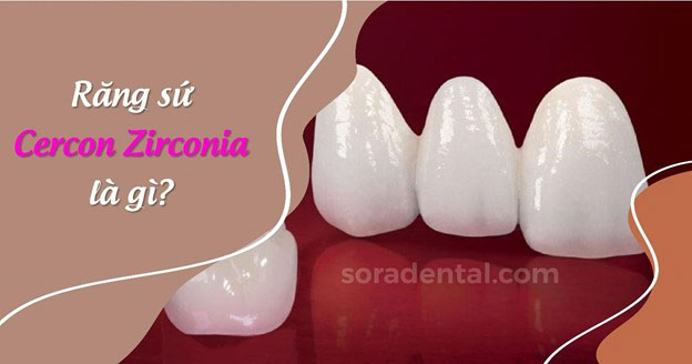 Read more about the article So sánh đặc điểm khác biệt giữa răng sứ Zirconia và Cercon