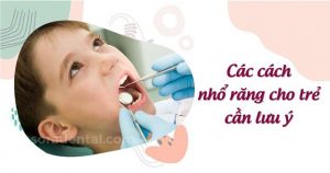 Các cách nhổ răng cho trẻ cần lưu ý