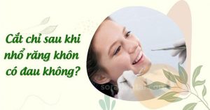 Read more about the article Cắt chỉ sau khi nhổ răng khôn có đau không?