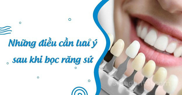 Read more about the article Chế độ ăn uống cần lưu ý sau khi bọc răng sứ