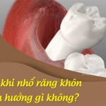 Lỗ sau khi nhổ răng khôn có ảnh hưởng gì không?