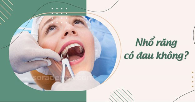 Read more about the article Nhổ răng có đau không? Chăm sóc sau khi nhổ răng