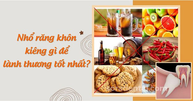 Read more about the article Nhổ răng khôn kiêng gì, ăn gì để nhanh lành nhất?