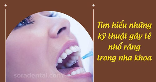 Những kỹ thuật gây tê nhổ răng trong nha khoa
