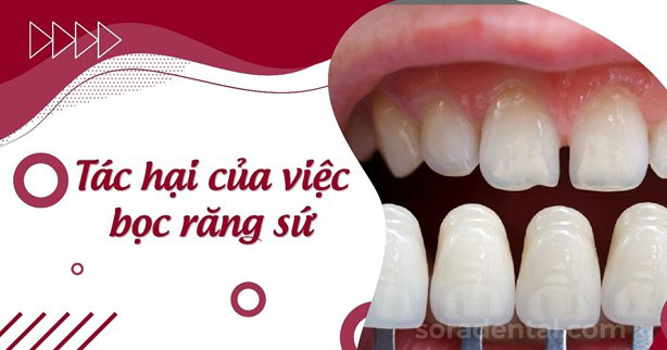 Read more about the article Những tác hại của việc bọc răng sứ thường gặp