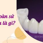 Răng sứ Zirconia Là Gì? Có thật sự tốt không?