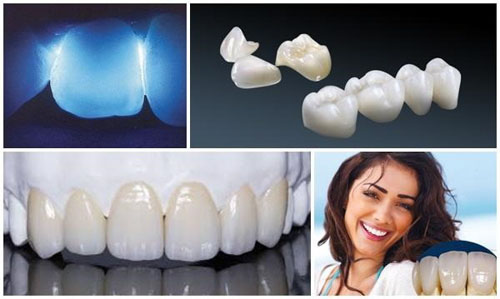 Răng sứ Zirconia sở hữu nhiều ưu điểm nổi bật