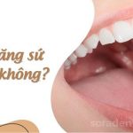 Tháo răng sứ có đau không? Làm lại như thế nào