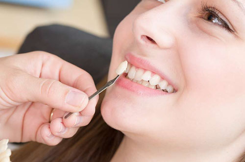 Bọc răng sứ cải thiện tình trạng răng khểnh