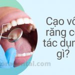 Cạo vôi răng có tác dụng gì? Có ảnh hưởng gì không?