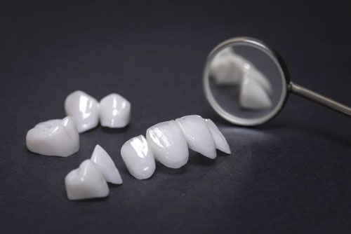 Chi phí bọc răng sứ có sự khác nhau giữa các loại răng sứ