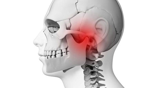 Loạn năng thái dương hàm có thể gây ra những cơn đau nhức ở vùng tai
