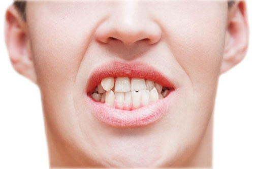 Mất răng sữa sớm sẽ khiến răng vĩnh viễn có nguy cơ mọc lệch