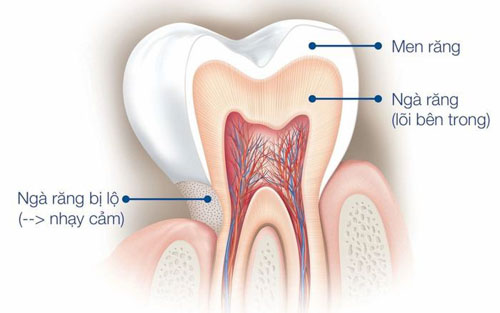 Men răng là lớp ngoài cùng bao bọc lấy ngà răng và tủy răng