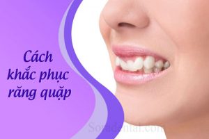 Read more about the article Cách khắc phục răng quặp hiệu quả