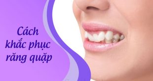Nguyên nhân dẫn đến răng quặp và cách khắc phục