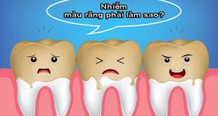 Nguyên nhân răng nhiễm Tetra và cách khắc phục hiệu quả