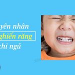 Nguyên nhân trẻ nghiến răng khi ngủ và cách khắc phục