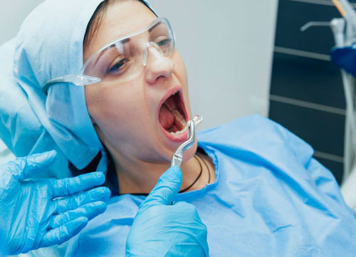 Nhổ răng khi răng hàm không có khả năng phục hồi