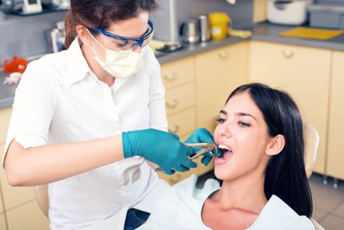 Nhổ răng khôn điều trị viêm lợi trùm