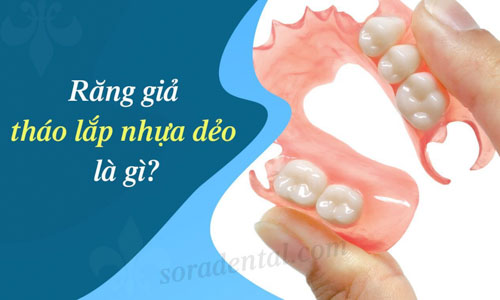 Răng giả tháo lắp nhựa dẻo là gì?