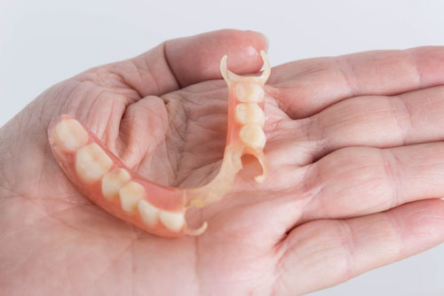 Răng giả tháo lắp nhựa dẻo là loại hàm có nền nướu được cấu tạo từ nhựa dẻo nha khoa