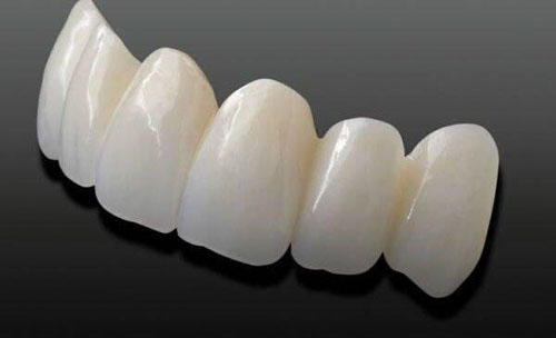 Răng sứ Cercon được sản xuất bằng công nghệ CAD/CAM