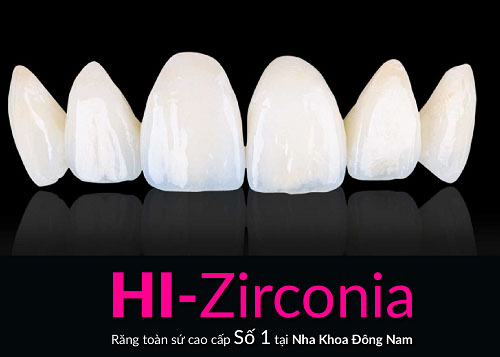 Răng sứ Hi-Zirconia cho khả năng chống nứt gãy, mài mòn cao