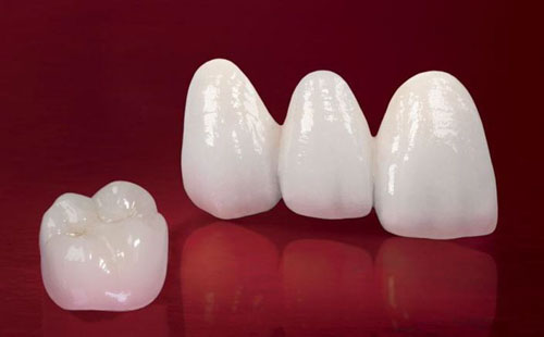 Răng sứ Zirconia cho độ thấu quang cao