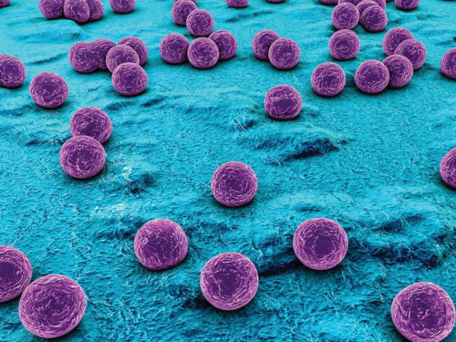 Vi khuẩn Staphylococcus Aureus là nguyên nhân phổ biến nhất gây viêm tuyến nước bọt