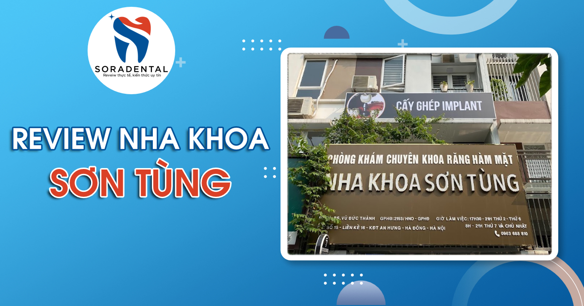 Read more about the article Review Nha Khoa Sơn Tùng: Đánh Giá Chất Lượng Và Bảng Giá Dịch Vụ